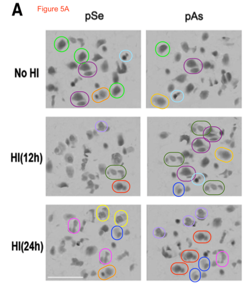 Gasping for air: 18 papers from Sichuan University and&nbsp;UCSF