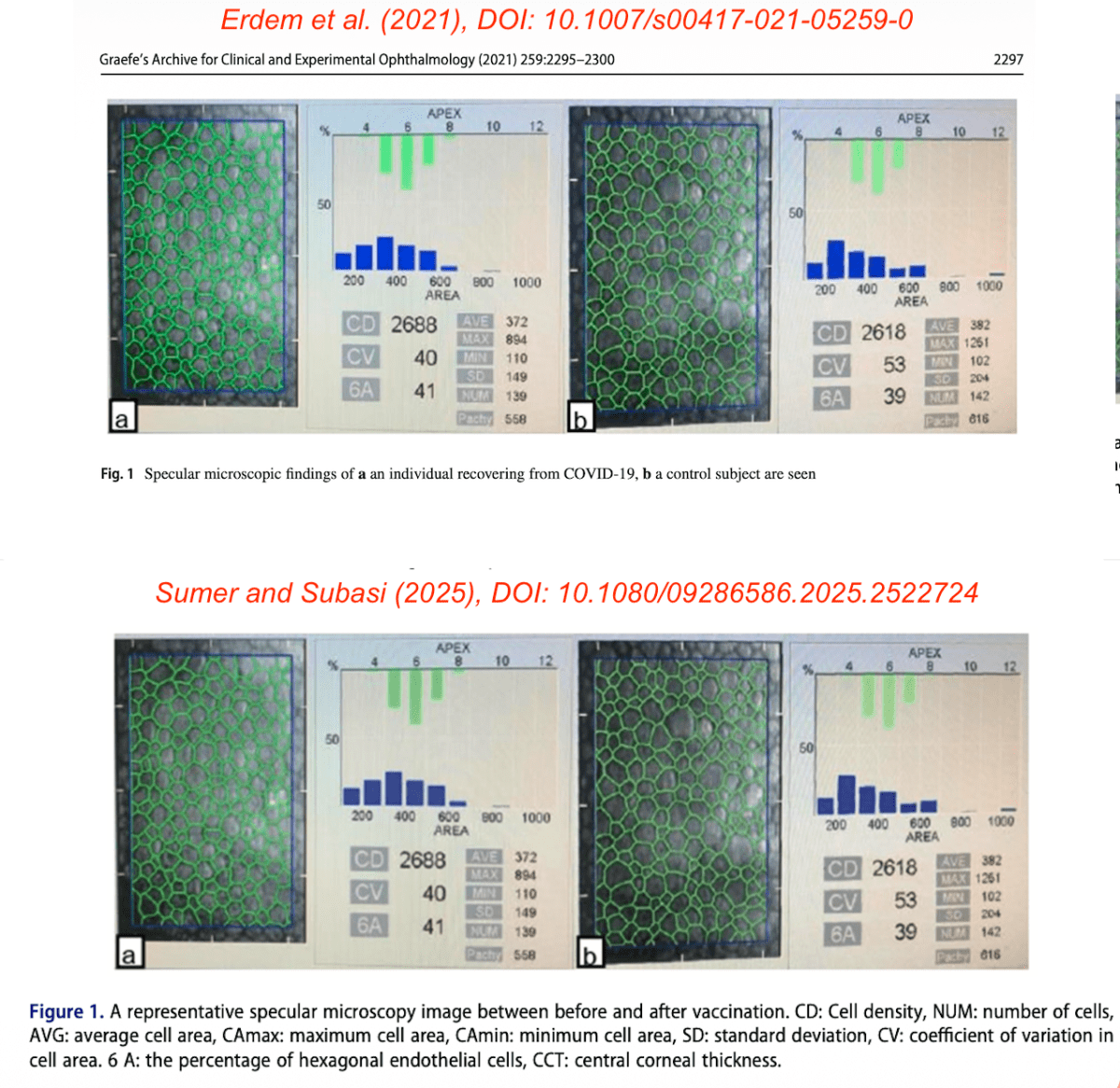 COVID-19-vaccine-induced eye damage? Reused images, impossible demographics, and an incomplete ethics approval&nbsp;number